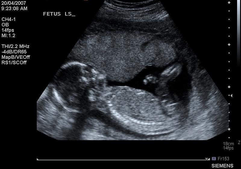 Baby Loss Awareness Week - Azana Photo Frames