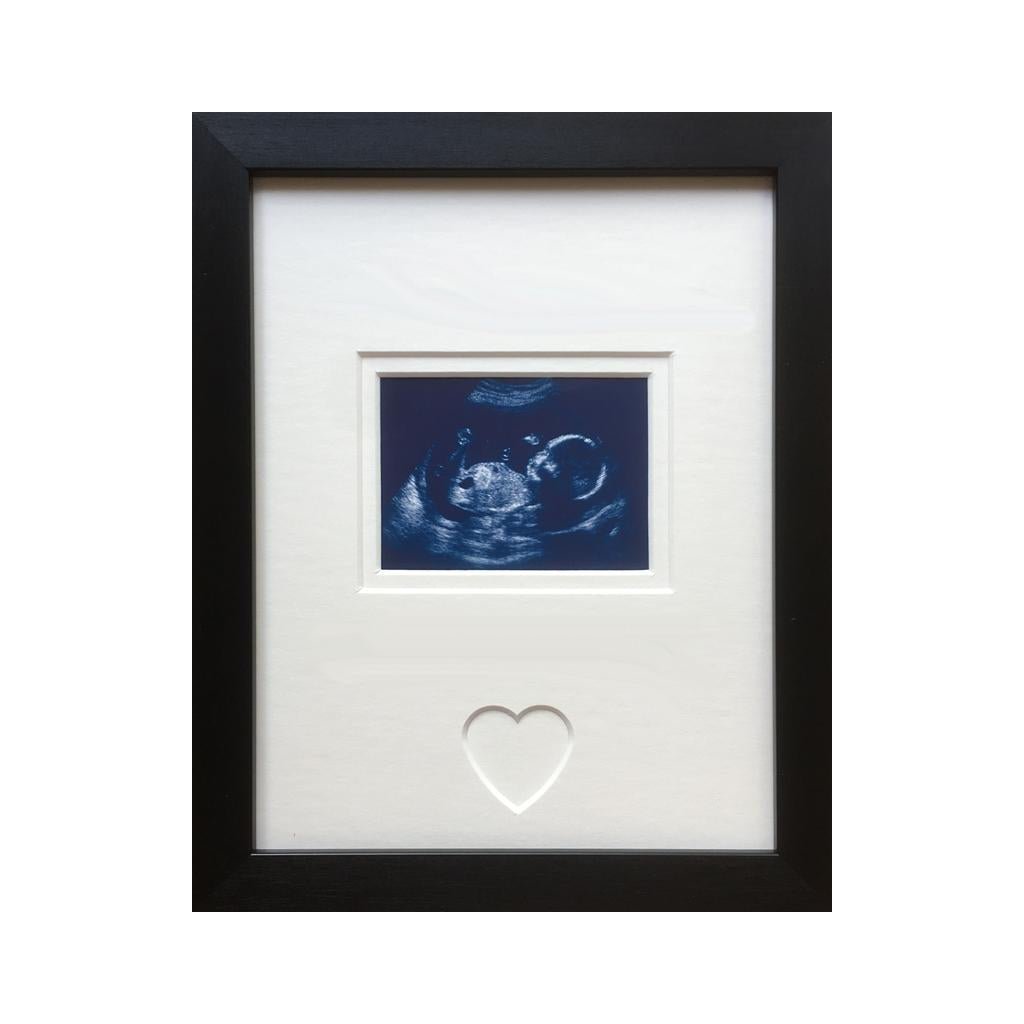 First Scan Picture Frame, Black - Azana Photo Frames