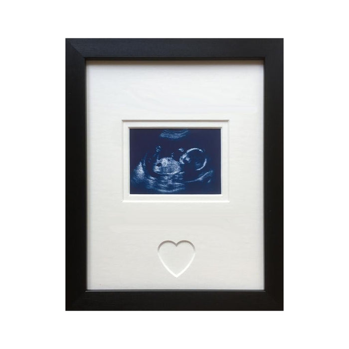 First Scan Picture Frame, Black - Azana Photo Frames