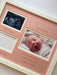 Baby Double Scan and First Photo Frame 12 x 10 Pink