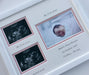 Personalised Girl 1st and 2nd Scan Double Picture Frame Landscape