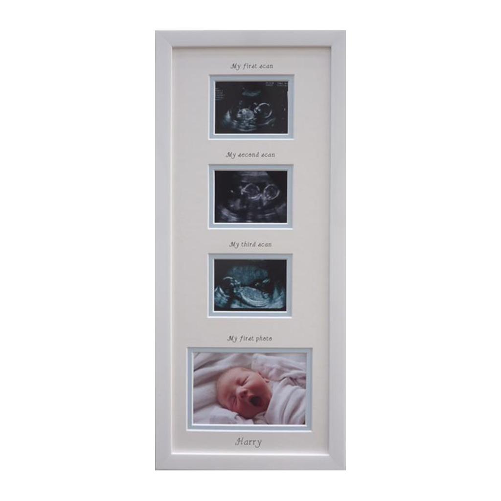 Triple Scan Frame & Mount