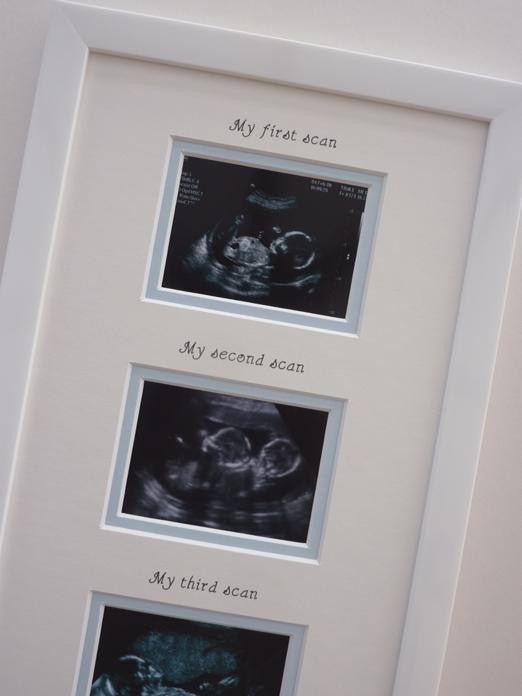 Triple personalised boy 3x sonogram photos