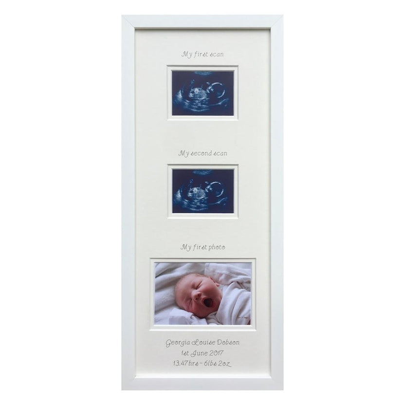 Pregnancy Scan Picture Gifts | Azana Photo Frames