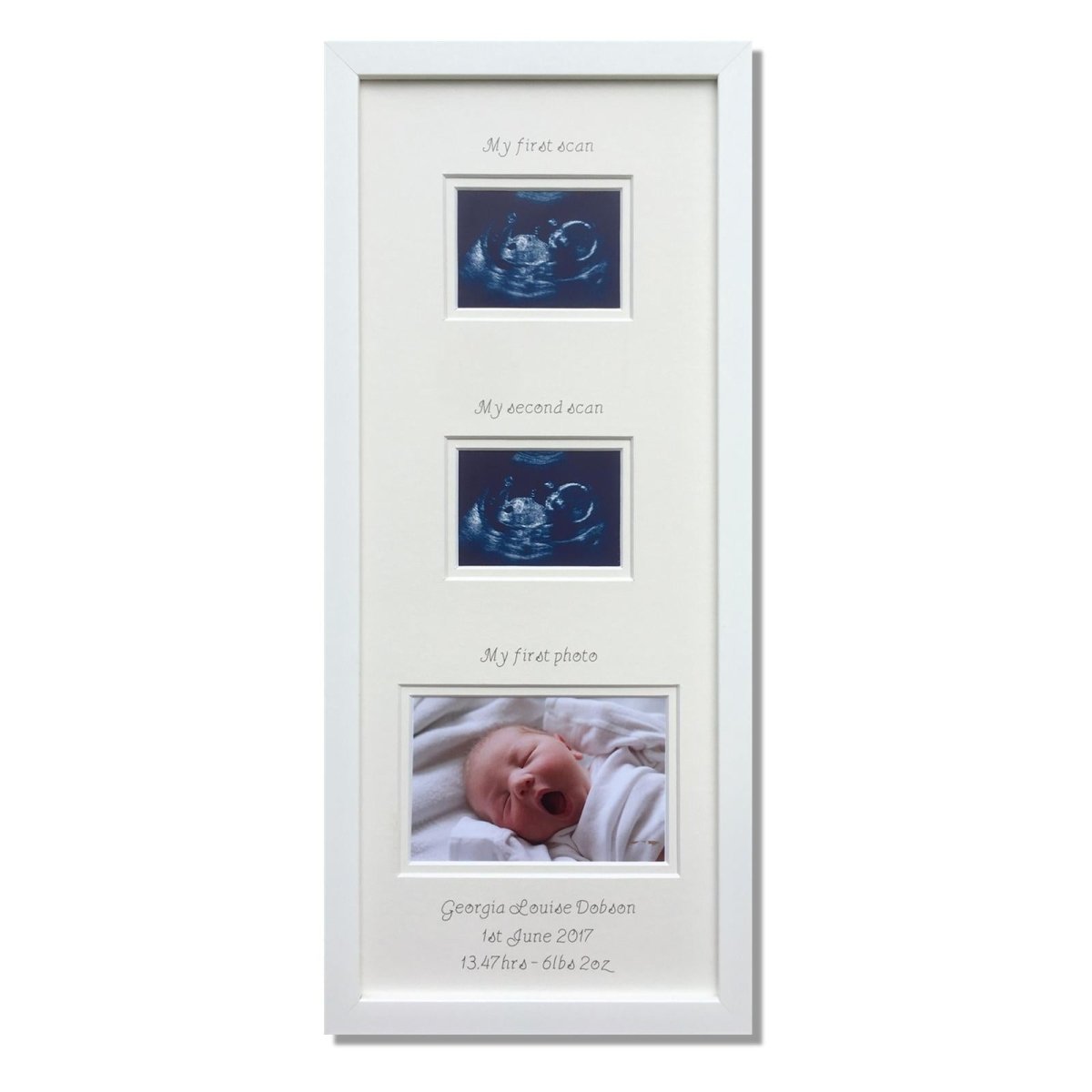 Pregnancy Scan Picture Gifts | Azana Photo Frames