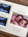 Triplets Twins Ultrasound Scan Picture Frame Gift 12 x 10 Oak Wood-Effect