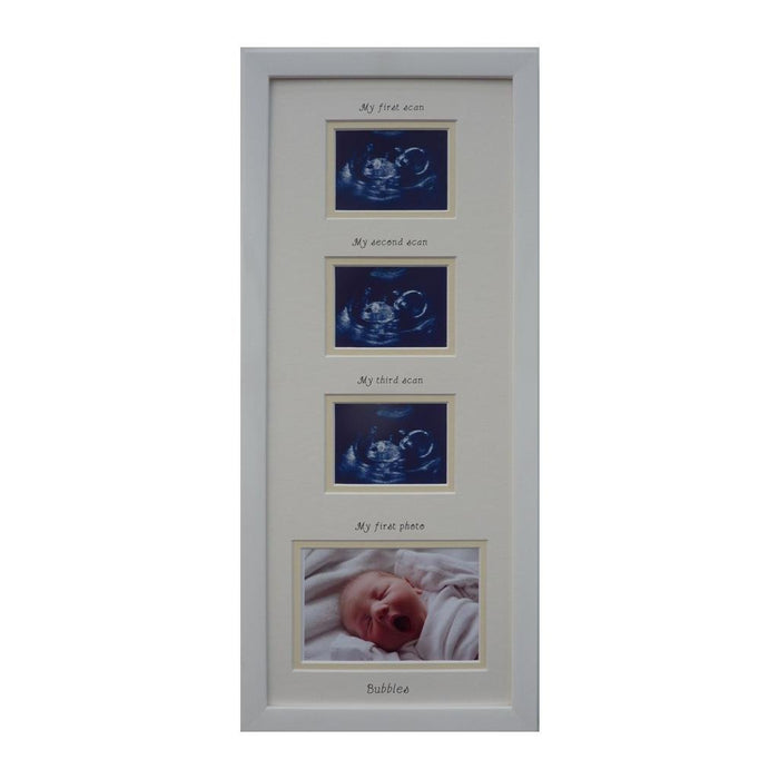 Triple baby scan frame